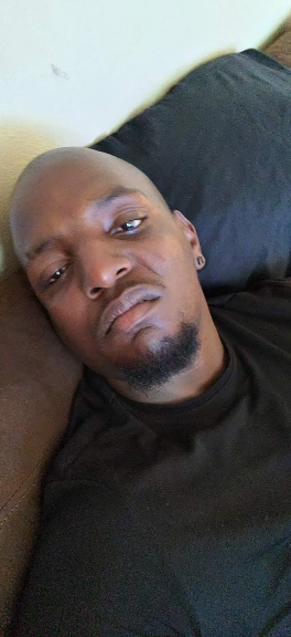 baldhead34